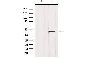 Western blot analysis of extracts from SP2/0, using Aurora Kinase Antibody. (Aurora A Antikörper  (Internal Region))