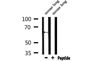 Western blot analysis of extracts from mouse lung, using CEACAM20 Antibody. (CEACAM20 Antikörper  (Internal Region))