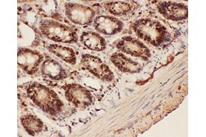 IHC-P testing of rat intestine tissue (Beclin 1 Antikörper  (AA 1-354))