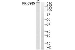 Western blot analysis of extracts from Jurkat cells, using PRIC285 antibody. (HELZ2 Antikörper)