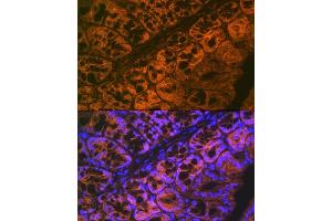 Immunofluorescence analysis of mouse large intestine using  Rabbit mAb (ABIN7265434) at dilution of 1:100 (40x lens). (ADAM15 Antikörper)