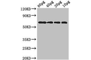 Western Blot Positive WB detected in: Rosseta bacteria lysate at 80 μg, 40 μg, 20 μg, 10 μg All lanes: yedQ antibody at 2. (DgcQ (AA 381-564) Antikörper)