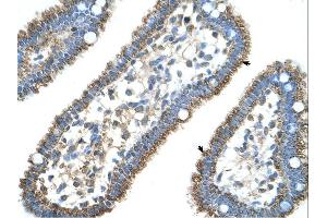 Immunohistochemistry (IHC) image for anti-Carbamoyl-Phosphate Synthase 1, Mitochondrial (CPS1) (Middle Region) antibody (ABIN2782319) (CPS1 Antikörper  (Middle Region))
