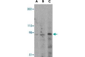 Western blot analysis of GRIK5 in human brain tissue lysate with GRIK5 polyclonal antibody  at (A) 0. (GRIK5 Antikörper  (C-Term))
