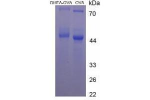 Image no. 2 for Dehydroepiandrosterone (DHEA) protein (Ovalbumin) (ABIN1880133)