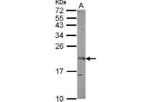 WB Image Sample (50 ug of whole cell lysate) A: mouse brain 12% SDS PAGE antibody diluted at 1:1000 (FGF12 Antikörper)