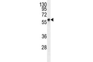 Glypican 3 antibody western blot analysis in HepG2 lysate (Glypican 3 Antikörper  (AA 335-365))