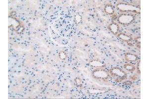 IHC-P analysis of Human Kidney Tissue, with DAB staining. (TLR3 Antikörper  (AA 404-532))