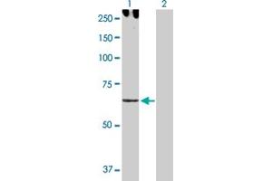 Western Blot analysis of CDH6 expression in transfected 293T cell line by CDH6 MaxPab polyclonal antibody. (CDH6 Antikörper  (AA 1-663))