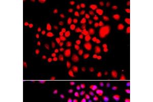 Immunofluorescence analysis of A549 cells using STK19 Polyclonal Antibody (STK19 Antikörper)
