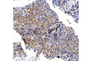 IHC analysis of CHCHD10 using anti-CHCHD10 antibody (ABIN7602507). (CHCHD10 Antikörper  (AA 80-142))
