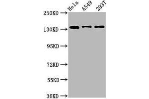 Western Blotting (WB) image for anti-Mannosidase, Alpha, Class 2B, Member 2 (MAN2B2) (AA 347-523) antibody (ABIN7151913)