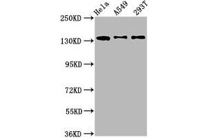 Western Blot Positive WB detected in: Hela whole cell lysate, A549 whole cell lysate, 293T whole cell lysate All lanes: MAN2B2 antibody at 1. (MAN2B2 Antikörper  (AA 347-523))