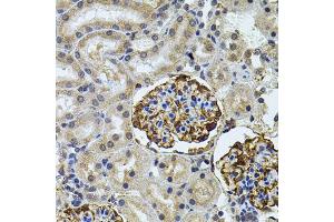 Immunohistochemistry of paraffin-embedded rat kidney using CETP antibody (ABIN5970634) (40x lens).