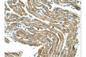 Immunohistochemistry (IHC) image for anti-Histidine Ammonia-Lyase (HAL) (C-Term) antibody (ABIN2782321) (HAL Antikörper  (C-Term))