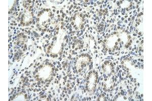 Immunohistochemistry (IHC) image for anti-TEA Domain Family Member 1 (SV40 Transcriptional Enhancer Factor) (TEAD1) (C-Term) antibody (ABIN2781167)