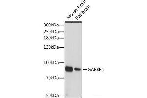 Western blot analysis of extracts of various cell lines using GABBR1 Polyclonal Antibody at dilution of 1:1000. (GABBR1 Antikörper)