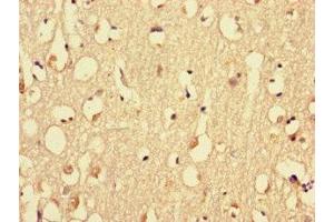 Immunohistochemistry (IHC) image for anti-Myosin Heavy Chain 3, Skeletal Muscle, Embryonic (MYH3) (AA 1-217) antibody (ABIN7160576)