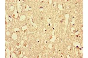 Immunohistochemistry of paraffin-embedded human brain tissue using ABIN7160576 at dilution of 1:100 (MYH3 Antikörper  (AA 1-217))