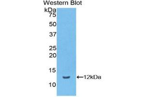 Western blot analysis of the recombinant protein. (Vitronectin Antikörper  (AA 19-111))