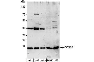 anti-Cytochrome C Oxidase Subunit Vb (COX5B) (AA 25-75) antibody