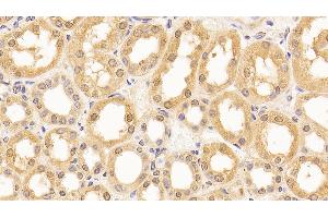 Detection of LMNB1 in Human Kidney Tissue using Anti-Lamin B1 (LMNB1) Monoclonal Antibody (Lamin B1 Antikörper  (AA 52-233))