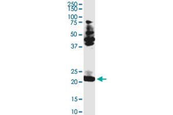 TCEAL3 Antikörper  (AA 1-200)
