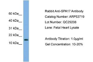 WB Suggested Anti-SPA17  Antibody Titration: 0. (SPA17 Antikörper  (N-Term))