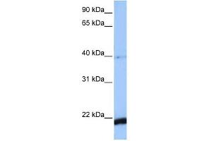 HBS1L antibody used at 1 ug/ml to detect target protein. (HBS1L Antikörper)
