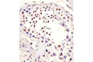 Antibody staining LIN28B in human testis tissue sections by Immunohistochemistry (IHC-P - paraformaldehyde-fixed, paraffin-embedded sections). (LIN28B Antikörper  (AA 95-128))