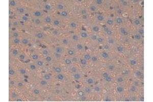 IHC-P analysis of Rat Liver Tissue, with DAB staining. (Haptoglobin Antikörper  (AA 70-332))