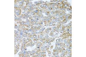 Immunohistochemistry (Paraffin-embedded Sections) (IHC (p)) image for anti-NADH Dehydrogenase (Ubiquinone) 1 alpha Subcomplex, 2, 8kDa (NDUFA2) (AA 1-95) antibody (ABIN6144461)