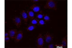 Proximity Ligation Assay (PLA) image for AKT1 & SMAD3 Protein Protein Interaction Antibody Pair (ABIN1340030)