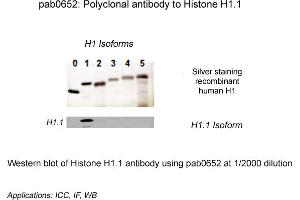 Image no. 1 for anti-Histone H1.1 (HIST1H1A) (N-Term) antibody (ABIN410162) (Histone H1.1 Antikörper  (N-Term))