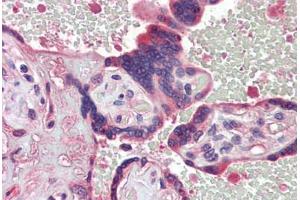 Human Placenta (formalin-fixed, paraffin-embedded) stained with  antibody ABIN462272 followed by biotinylated secondary antibody, alkaline phosphatase-streptavidin and chromogen. (TDP1 Antikörper  (AA 1-298))