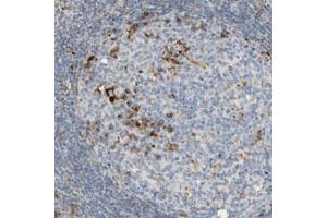 Immunohistochemical staining (Formalin-fixed paraffin-embedded sections) of human tonsil with CECR1 polyclonal antibody  shows strong cytoplasmic positivity in germinal center cells. (CECR1 Antikörper)
