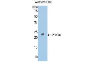 Western Blotting (WB) image for anti-Vitamin D-Binding Protein (GC) (AA 209-394) antibody (ABIN1858610)