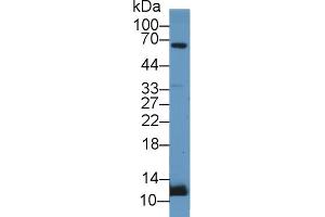Detection of UCN2 in Rat Adrenal gland lysate using Polyclonal Antibody to Urocortin 2 (UCN2) (Urocortin 2 Antikörper  (AA 20-112))