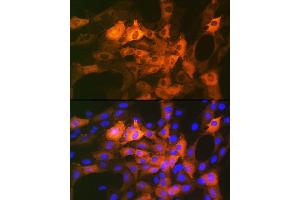 Immunofluorescence analysis of C6 cells using CRYAB Rabbit mAb (ABIN7266528) at dilution of 1:100 (40x lens).