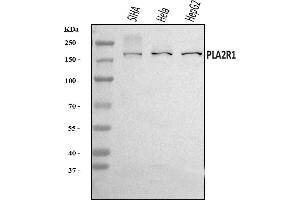 Western blot analysis of PLA2R/PLA2R1 using anti-PLA2R/PLA2R1 antibody (ABIN7600628).