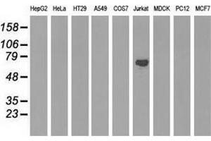 Western blot analysis of extracts (35 µg) from 9 different cell lines by using anti-ARHGAP25 monoclonal antibody. (ARHGAP25 Antikörper)
