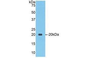 Western blot analysis of recombinant Human NCCT. (SLC12A3 Antikörper  (AA 867-1024))