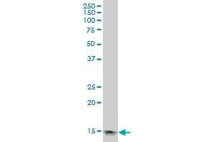 PFN1 polyclonal antibody (A01), Lot # Abnova060427QCS1 Western Blot analysis of PFN1 expression in HeLa . (PFN1 Antikörper  (AA 1-140))