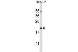 Western Blotting (WB) image for anti-NADH Dehydrogenase (Ubiquinone) 1 alpha Subcomplex, Assembly Factor 2 (NDUFAF2) antibody (ABIN2997290) (NDUFAF2 Antikörper)