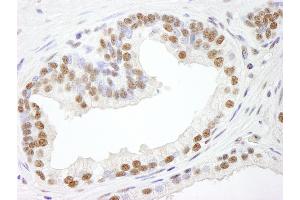 Immunohistochemistry (IHC) image for anti-RNA Binding Motif Protein 25 (RBM25) (AA 475-525) antibody (ABIN7448762) (RBM25 Antikörper  (AA 475-525))