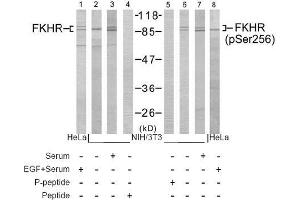 Image no. 1 for anti-Forkhead Box O1 (FOXO1) (pSer256) antibody (ABIN196812) (FOXO1 Antikörper  (pSer256))