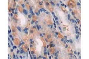 IHC-P analysis of stomach tissue, with DAB staining. (TUBB1 Antikörper  (AA 166-451))