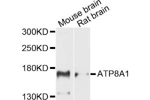 Western blot analysis of extracts of various cell lines, using ATP8A1 antibody (ABIN5971746) at 1/1000 dilution. (ATP8A1 Antikörper)