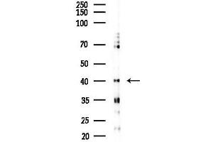 anti-Myb-Related Transcription Factor, Partner of Profilin (MYPOP) antibody