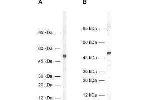 dilution: 1 : 1000, A: rat adrenal gland homogenate, B: mouse brain homogenate (DDC Antikörper)